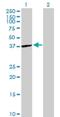 ST6 N-Acetylgalactosaminide Alpha-2,6-Sialyltransferase 6 antibody, H00030815-B01P, Novus Biologicals, Western Blot image 