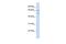 Tweety Family Member 1 antibody, GTX46704, GeneTex, Western Blot image 