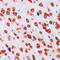 Doublecortin Like Kinase 3 antibody, LS-C353593, Lifespan Biosciences, Immunohistochemistry paraffin image 