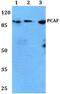 Lysine Acetyltransferase 2B antibody, PA5-75181, Invitrogen Antibodies, Western Blot image 