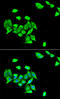 DNA Methyltransferase 3 Alpha antibody, STJ28586, St John