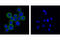 ERBB2 antibody, 2165S, Cell Signaling Technology, Immunocytochemistry image 