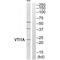 Vesicle Transport Through Interaction With T-SNAREs 1A antibody, A06649, Boster Biological Technology, Western Blot image 