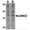 LEM Domain Containing 2 antibody, MBS150661, MyBioSource, Western Blot image 