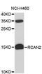 Regulator Of Calcineurin 2 antibody, STJ26649, St John