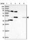 Potassium Voltage-Gated Channel Modifier Subfamily G Member 2 antibody, NBP2-14141, Novus Biologicals, Western Blot image 