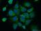 Acyl-CoA Binding Domain Containing 4 antibody, 20941-1-AP, Proteintech Group, Immunofluorescence image 