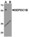 DEP Domain Containing 1B antibody, 8283, ProSci, Western Blot image 
