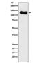 Discs Large MAGUK Scaffold Protein 1 antibody, M01287, Boster Biological Technology, Western Blot image 