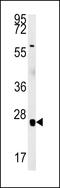 RNA Binding Motif Protein 24 antibody, MBS9212720, MyBioSource, Western Blot image 