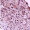 Interleukin-23 receptor antibody, orb10900, Biorbyt, Immunohistochemistry paraffin image 