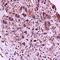 Interleukin 23 Receptor antibody, orb10900, Biorbyt, Immunohistochemistry paraffin image 