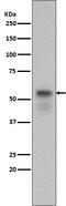 SMAD Family Member 3 antibody, P00059-1, Boster Biological Technology, Western Blot image 