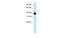 Tetratricopeptide Repeat Domain 19 antibody, MBS834300, MyBioSource, Western Blot image 