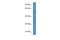 Phosphatidylinositol 4-Kinase Type 2 Beta antibody, A11023, Boster Biological Technology, Western Blot image 