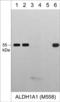 Aldehyde Dehydrogenase 1 Family Member A1 antibody, AM5581, ECM Biosciences, Western Blot image 