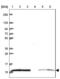 U6 snRNA-associated Sm-like protein LSm2 antibody, NBP2-38093, Novus Biologicals, Western Blot image 