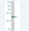 Solute Carrier Family 25 Member 18 antibody, H00083733-M02, Novus Biologicals, Western Blot image 