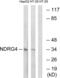 Protein NDRG4 antibody, abx014745, Abbexa, Western Blot image 