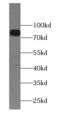 Anoctamin 10 antibody, FNab00441, FineTest, Western Blot image 