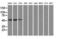 ATP Synthase F1 Subunit Beta antibody, LS-C114907, Lifespan Biosciences, Western Blot image 