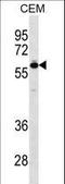 T-Box 5 antibody, LS-C161753, Lifespan Biosciences, Western Blot image 
