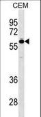 T-box transcription factor TBX5 antibody, LS-C161753, Lifespan Biosciences, Western Blot image 