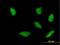 Homeobox A5 antibody, H00003202-M06, Novus Biologicals, Immunocytochemistry image 