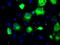 Proprotein Convertase Subtilisin/Kexin Type 7 antibody, LS-C114723, Lifespan Biosciences, Immunofluorescence image 