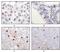 Lysine Acetyltransferase 5 antibody, A01393-1, Boster Biological Technology, Immunohistochemistry paraffin image 