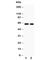 Transforming Growth Factor Beta Receptor 2 antibody, R30965, NSJ Bioreagents, Western Blot image 