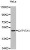 Cyp17 antibody, abx004682, Abbexa, Western Blot image 