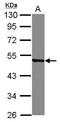 Y-Box Binding Protein 2 antibody, GTX116127, GeneTex, Western Blot image 