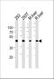 Ornithine Aminotransferase antibody, A01126-1, Boster Biological Technology, Western Blot image 