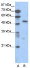 Transcription Factor 7 antibody, TA330117, Origene, Western Blot image 