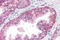 Catenin Alpha 1 antibody, MBS244866, MyBioSource, Immunohistochemistry frozen image 