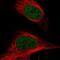 SET1 antibody, NBP1-88858, Novus Biologicals, Immunocytochemistry image 