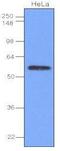 Interferon Regulatory Factor 3 antibody, GTX50058, GeneTex, Western Blot image 