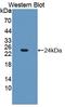Fibroblast Growth Factor 21 antibody, LS-C373070, Lifespan Biosciences, Western Blot image 