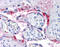 Integrin Subunit Beta 3 antibody, 51-342, ProSci, Immunohistochemistry paraffin image 