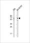 Anti-Mullerian Hormone antibody, 64-198, ProSci, Western Blot image 