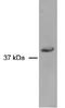 RAD51 Paralog D antibody, NB100-178, Novus Biologicals, Western Blot image 