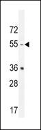 5-Hydroxytryptamine Receptor 2B antibody, 55-649, ProSci, Western Blot image 