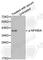 NFKB Inhibitor Alpha antibody, AP0420, ABclonal Technology, Western Blot image 