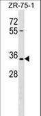 Olfactory Receptor Family 2 Subfamily L Member 8 (Gene/Pseudogene) antibody, LS-C158465, Lifespan Biosciences, Western Blot image 