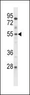 ETS Variant 6 antibody, 57-766, ProSci, Western Blot image 