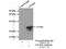 Chromosome 5 Open Reading Frame 24 antibody, 24319-1-AP, Proteintech Group, Immunoprecipitation image 