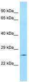 Signal Regulatory Protein Beta 2 antibody, TA334081, Origene, Western Blot image 