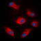 Ribosomal Protein S6 Kinase B1 antibody, LS-C354084, Lifespan Biosciences, Immunofluorescence image 