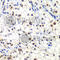 General Transcription Factor IIF Subunit 2 antibody, A5826, ABclonal Technology, Immunohistochemistry paraffin image 